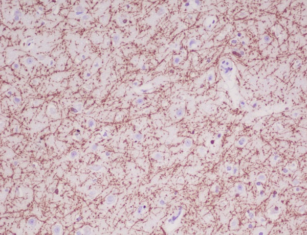 IHC - Anti-Myelin Basic Protein MBP Rabbit Monoclonal Antibody ABO14277